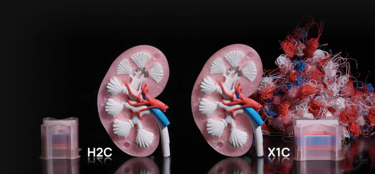 3Dプリンターで作られた2つの腎臓の解剖学的モデル