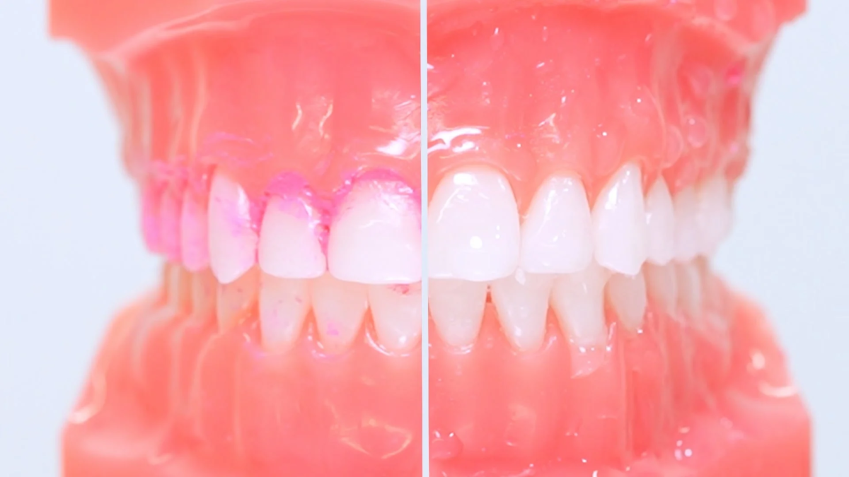 歯ブラシとの比較